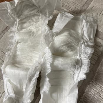 Kocaeli İzmit'ten Aldığım Baby Turco Bezin Kalite Sorunu