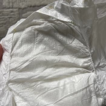 Kocaeli İzmit'ten Aldığım Baby Turco Bezin Kalite Sorunu