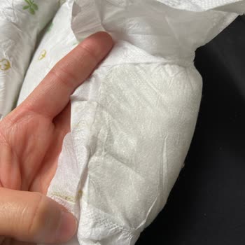 Kocaeli İzmit'ten Aldığım Baby Turco Bezin Kalite Sorunu