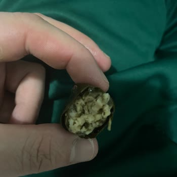 Migros Mezzaluna Beni Zor Durumda Bıraktı