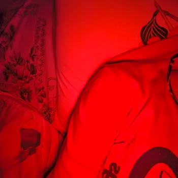 Xiaomi Telefon Ön Kamera Şikayeti