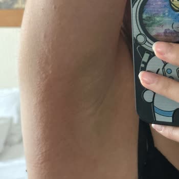 Agiss Marka Ağda Yüzümü Mahvetti