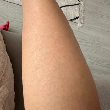 Agiss Marka Ağda Yüzümü Mahvetti