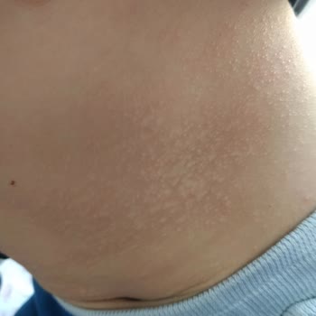 Edis Pharma İlaç Losyondan Asla Memnun Kalmadım