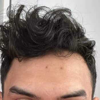 Eylül Öztürk Nail Spa Suratım Da Ki İz Geçmiyor