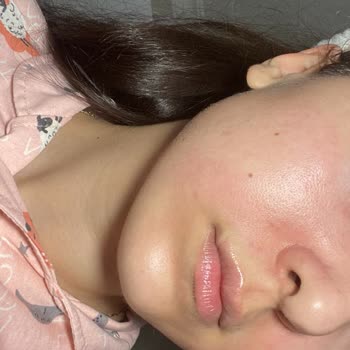 Watsons Cilt Yakan Ürün İade Almama