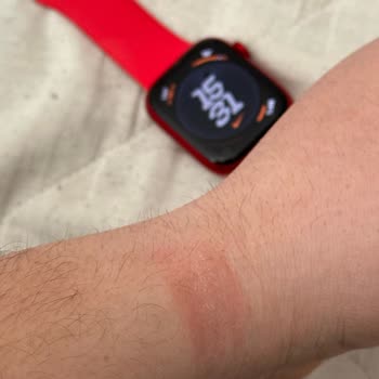 Apple Silikon Kordon Yara Yapıyor