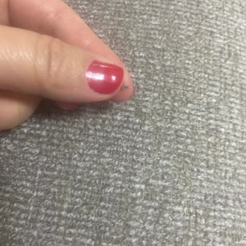 İstikbal Mitre Koltuk Takımı Kumaş Sorunu