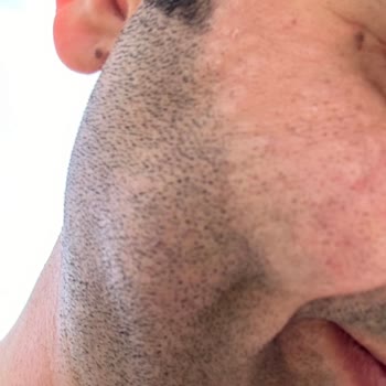 Novar Poliklinik Novar Lazer Epilasyon Bayraklı Şubesi