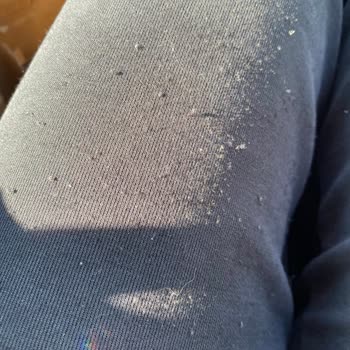 Askı Nişantaşı Şikayet Ürün Hemen Tiftiklendi