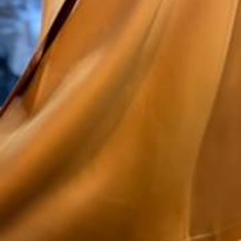 Dry Center Kuru Temizleme Kuru Temizleme Hizmeti Sonrası Yaşanan Mağduriyet