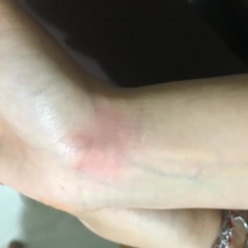 Bingo Sıvı Deterjan Alerji Yapıyor.