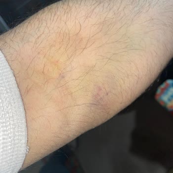 Türk Kızılay&nbsp; Şikayetçiyim Kızılay'dan!