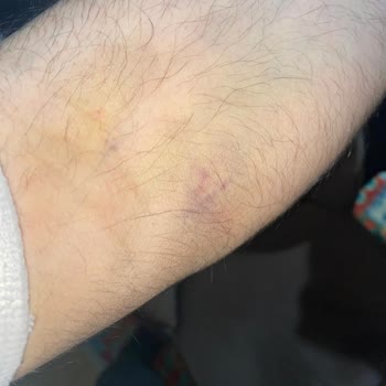 Türk Kızılay&nbsp; Şikayetçiyim Kızılay'dan!