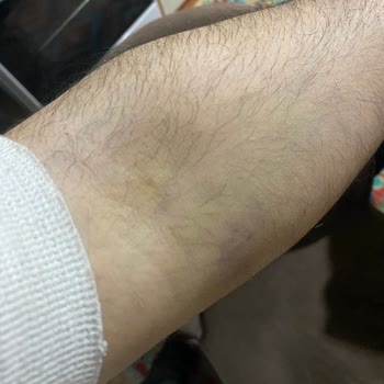 Türk Kızılay&nbsp; Şikayetçiyim Kızılay'dan!