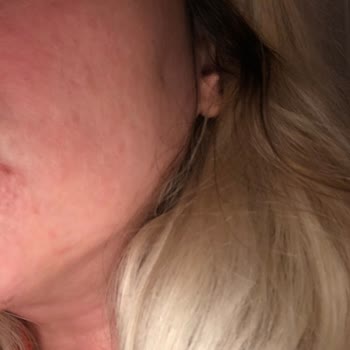 The Purest Solutions Purest C Vitamini