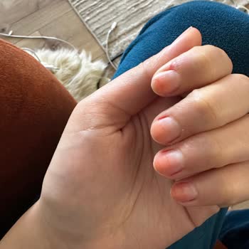 Flormar Ürünü Turuncu Tırnak Sorunu