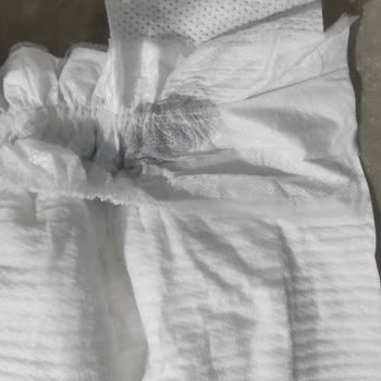 Molfix Bebek Bezimizde Yabancı Cisim Çıktı