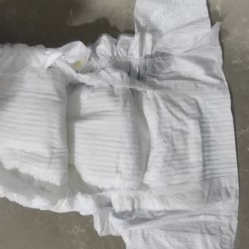 Molfix Bebek Bezimizde Yabancı Cisim Çıktı