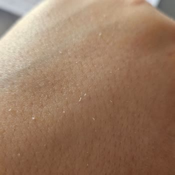 Neutrogena Yoğun Bakım Kremi