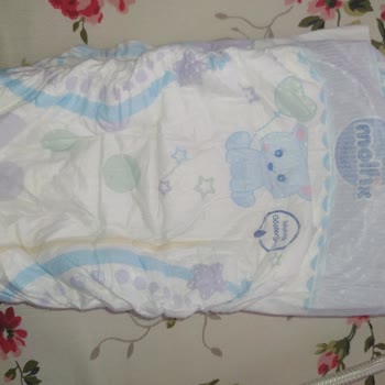 Molfix Bebek Bezi Sızdırma Yapıyor