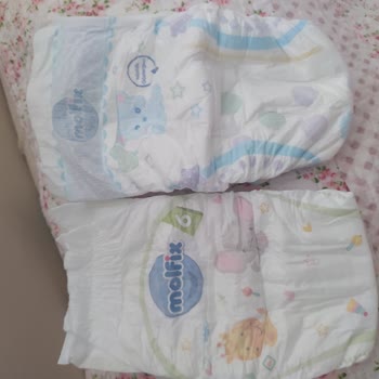 Molfix Bebek Bezi Sızdırma Yapıyor