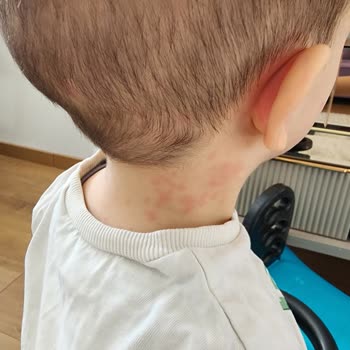 Bioderma ABC Derm Şampuan