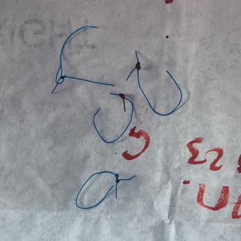 Novita Estetik Merkezi Şakak Germe Operasyonu