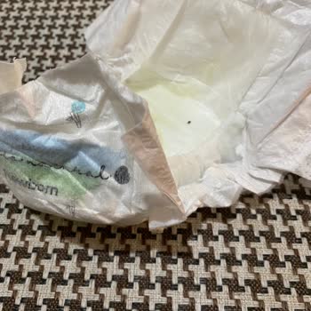 Sleepy Bebek Bezinde Böcek Çıktı!