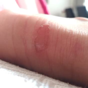 Deichmann Ayaklarım Yara Bere İçinde Kaldı Gerçekten Hayal Kırıklığına Uğrattı