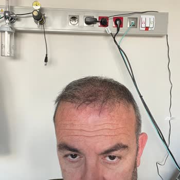 Atlas Hair Center Fiyaskosu
