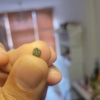 Gold Harvest Kuruyemiş Dişim Kırıldı!