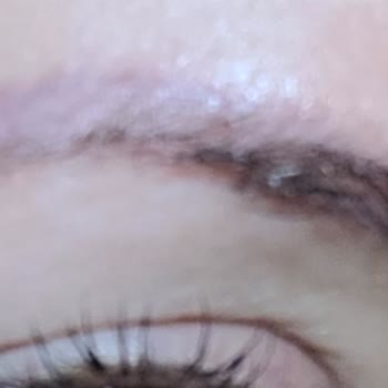 Özel FGM Polikliniği Mikroblading İşlemi Sonrası