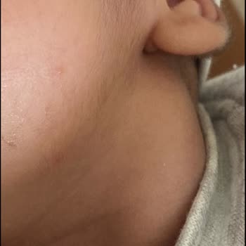 Medova Hastanesi Medova Doğum Doktoru Ve Yoğun Bakım Şikayeti