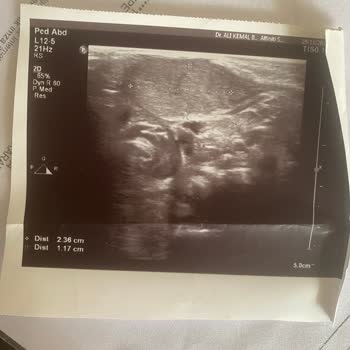 Medova Hastanesi Medova Doğum Doktoru Ve Yoğun Bakım Şikayeti