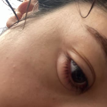 Nivea Micellar Suyu Tahriş Ediyor!