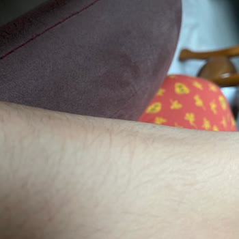 Büşra Yolcu Kuaför Güzellik Hayal Kırıklığına Uğratan Lazer Deneyimi