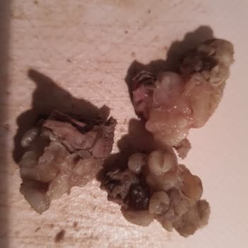 Migros'tan Sinir Ve Yağ Parçaları Dolu Et