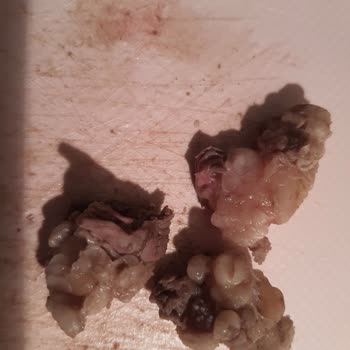 Migros'tan Sinir Ve Yağ Parçaları Dolu Et