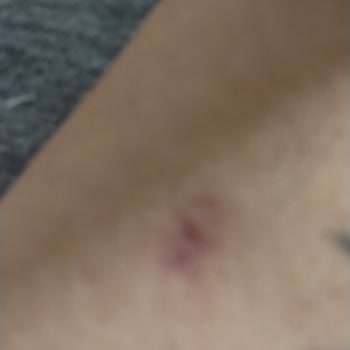 Enza Güzellik Merkezleri Yüz Epilasyonda Kaş Ortasını Yaktılar