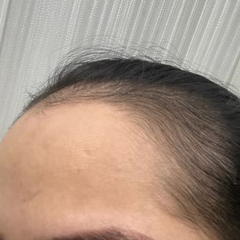 Meltem Küçük Phiacademy İzmir Kaş Yapımı Sonrası Oluşan Sorun