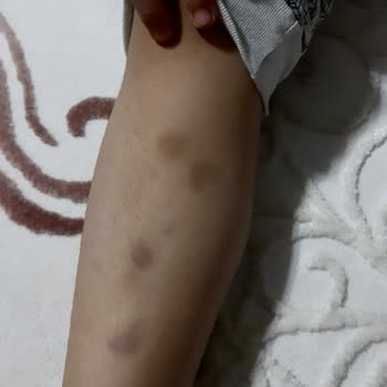 Ted Okulları Batman Merkez Hayal Kırıklığına Uğrattı!