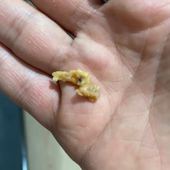 BİM Dönerim İçinden Çıkan Kemik