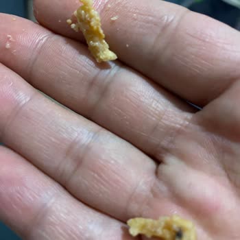 BİM Dönerim İçinden Çıkan Kemik