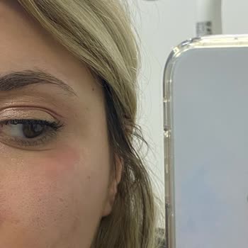 La Roche- Posay Cildimi Yaktı
