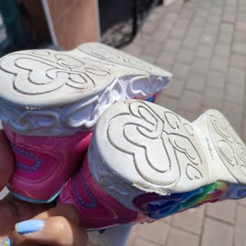 Skechers 3 Günde Tabanı Ezildi, Deforme Oldu