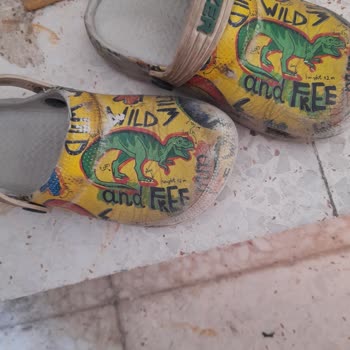 Gezer Terlik Koptu Ve Diğeri De Ayağına Vurdu Yara Oldu