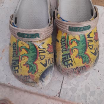 Gezer Terlik Koptu Ve Diğeri De Ayağına Vurdu Yara Oldu