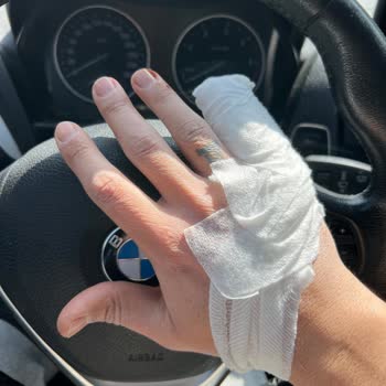 Manisa Büyükşehir Belediyesi M***** K****** Başıboş Köpek Saldırısı