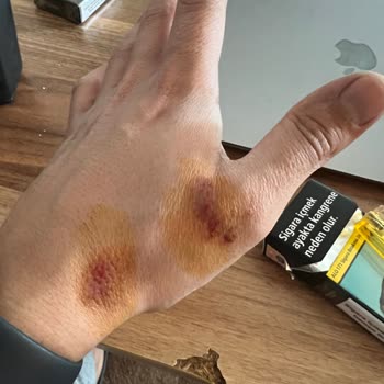 Manisa Büyükşehir Belediyesi M***** K****** Başıboş Köpek Saldırısı